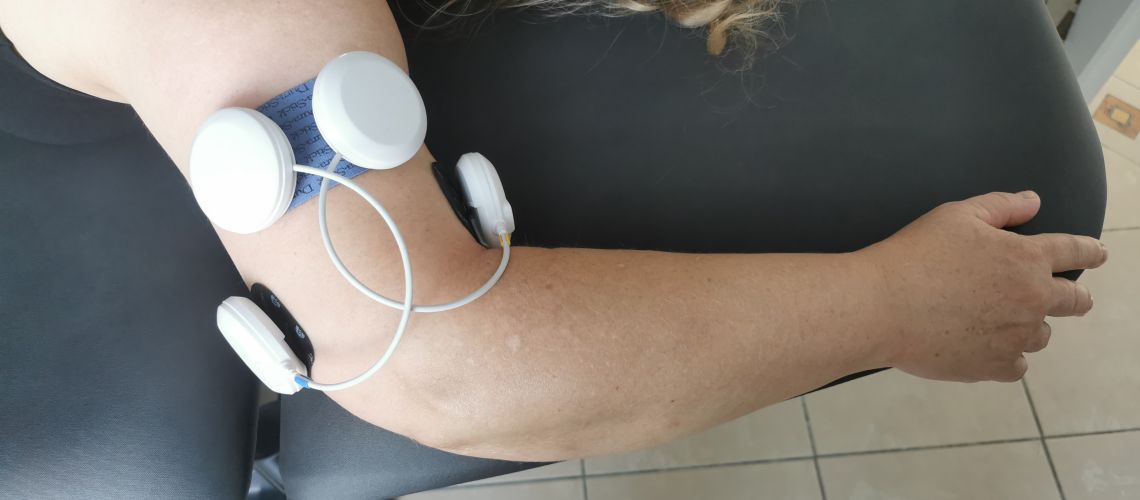 Elektrostimulacija